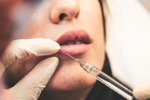 Lip injection filler 1500x1000