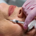 Anti wrinkle injection 3 2