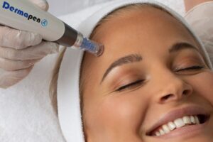 Model for dermapen 4