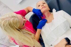 Pdo thread lift at rejuva cosmetic clinic